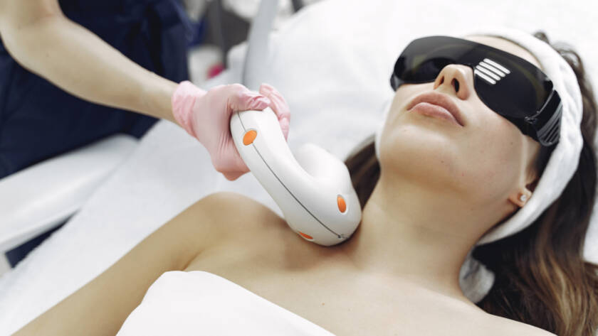 laser hair removal