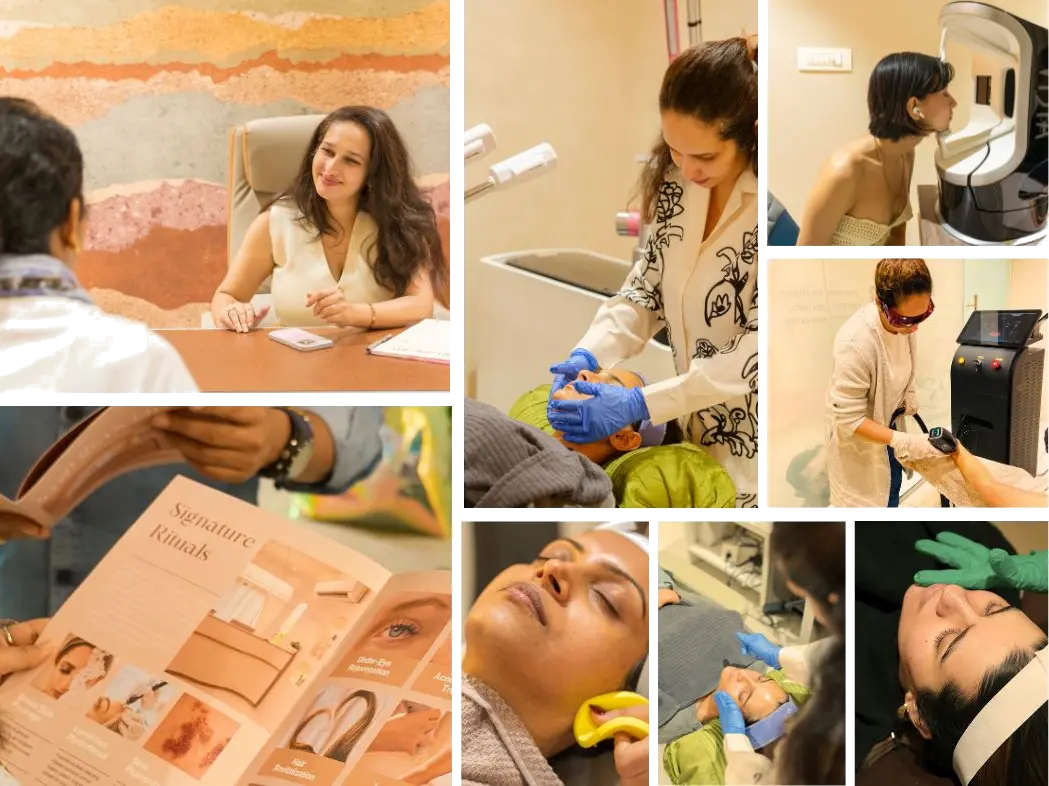 Acne Treatment Collage