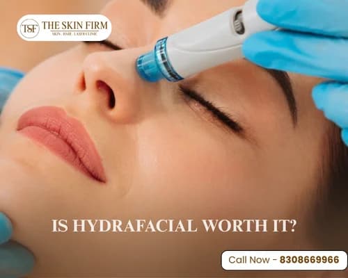 hydrafacial in pune