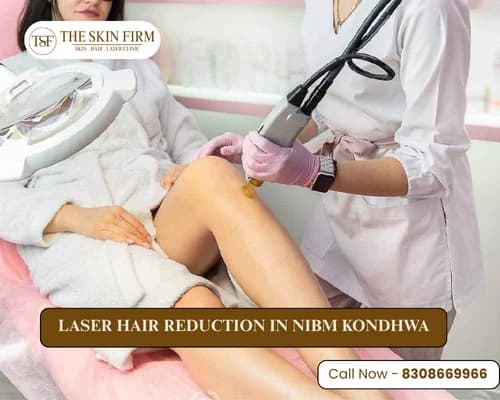 Laser Hair Removal in NIBM Kondhwa