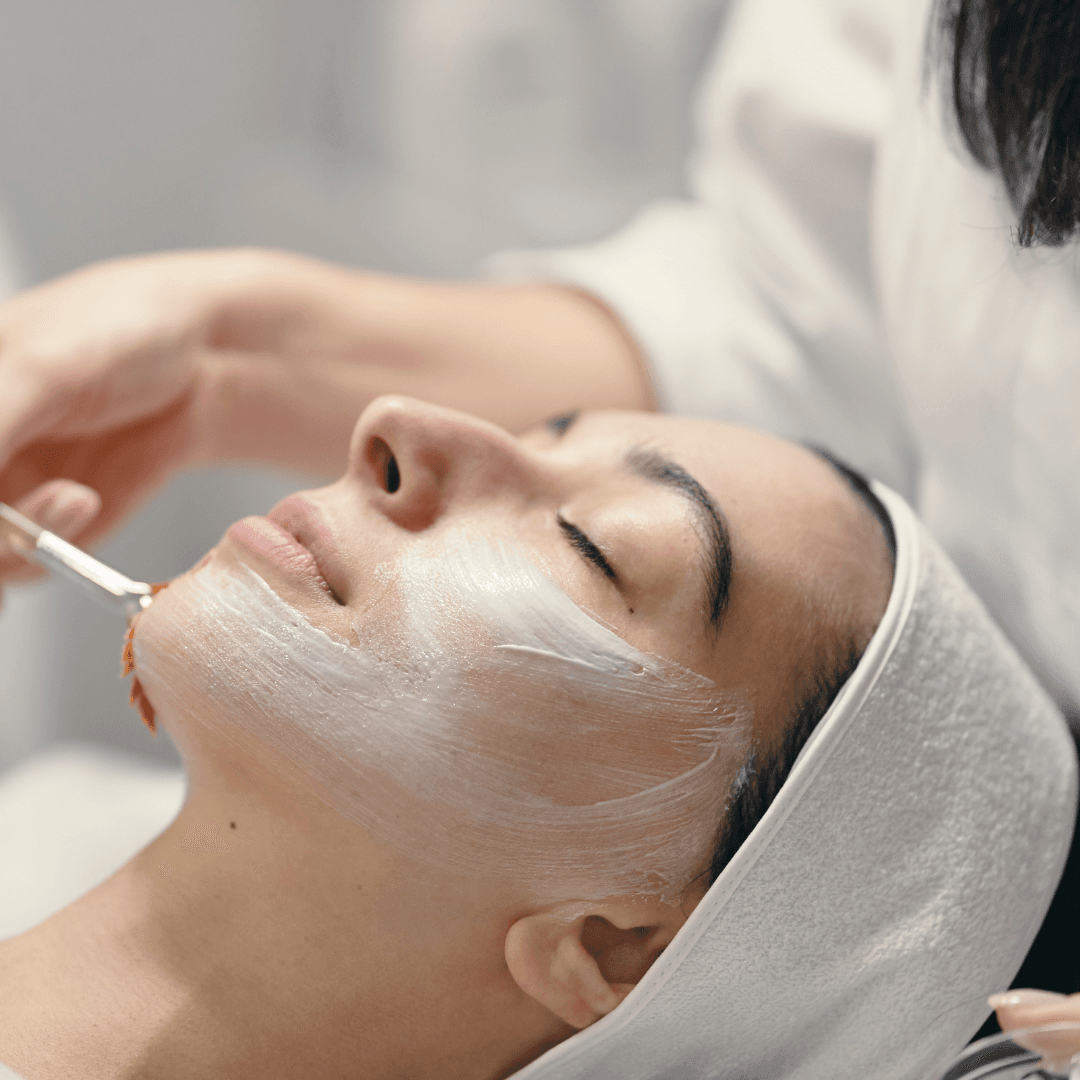 Chemical Peel