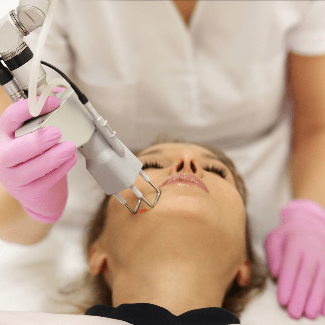 CO₂ Laser Skin Treatment