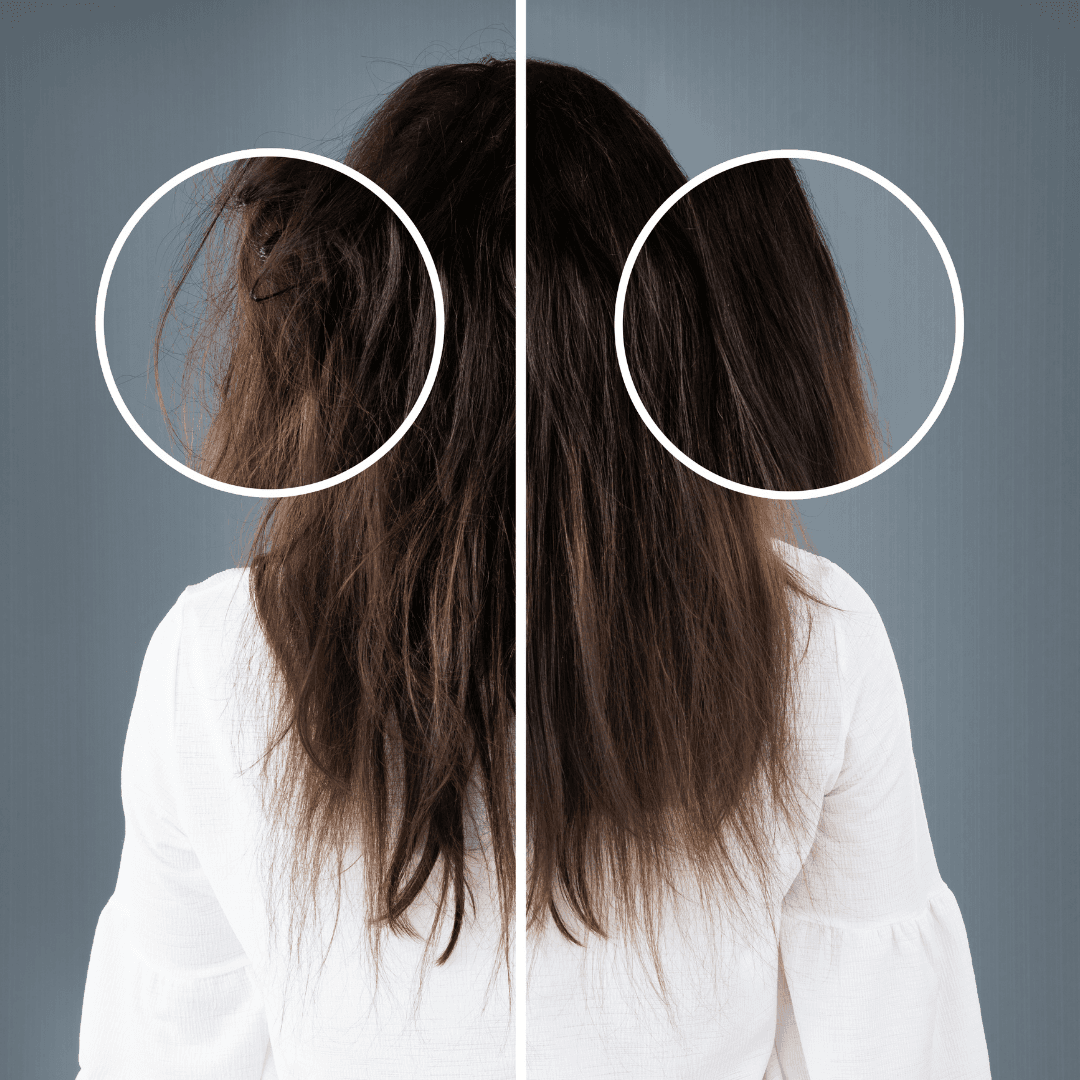 Hair Regrowth & Density Improvement