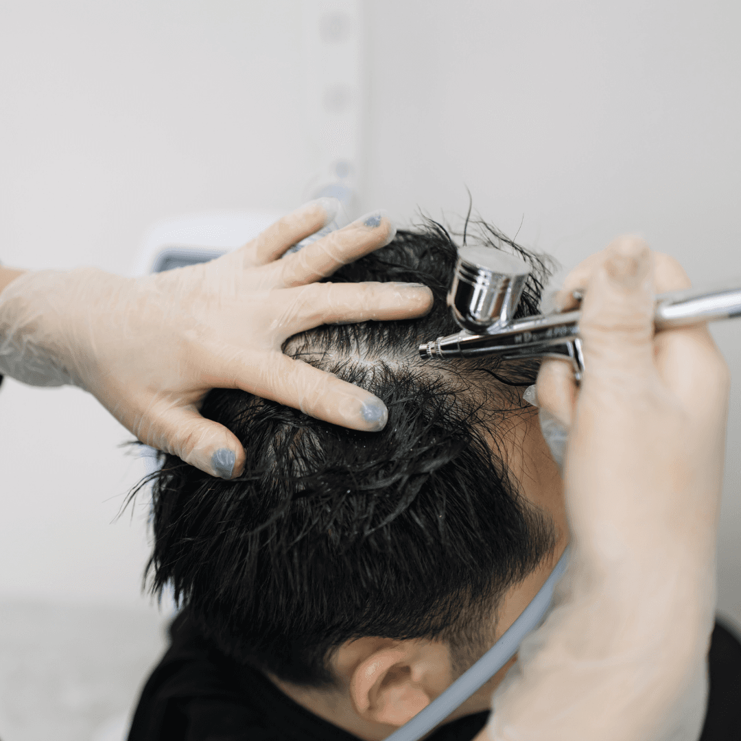 Hair Mesotherapy