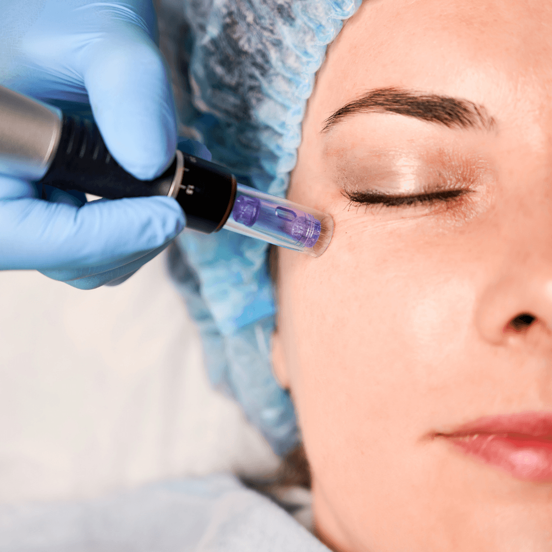 Mesotherapy
