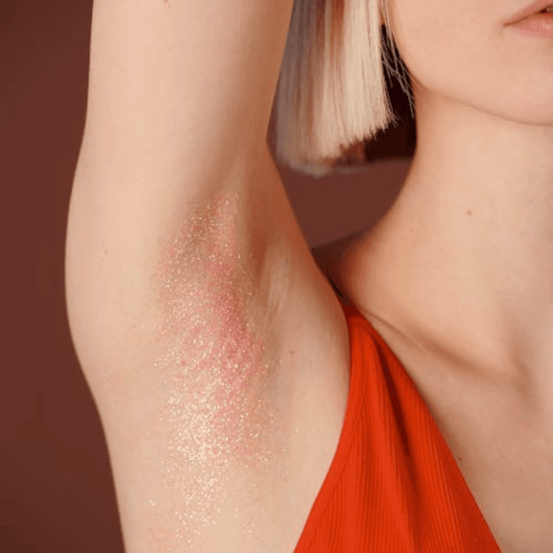 Underarm Whitening
