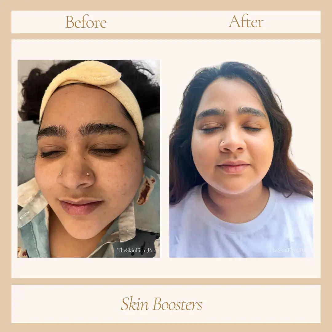 Treatment 8