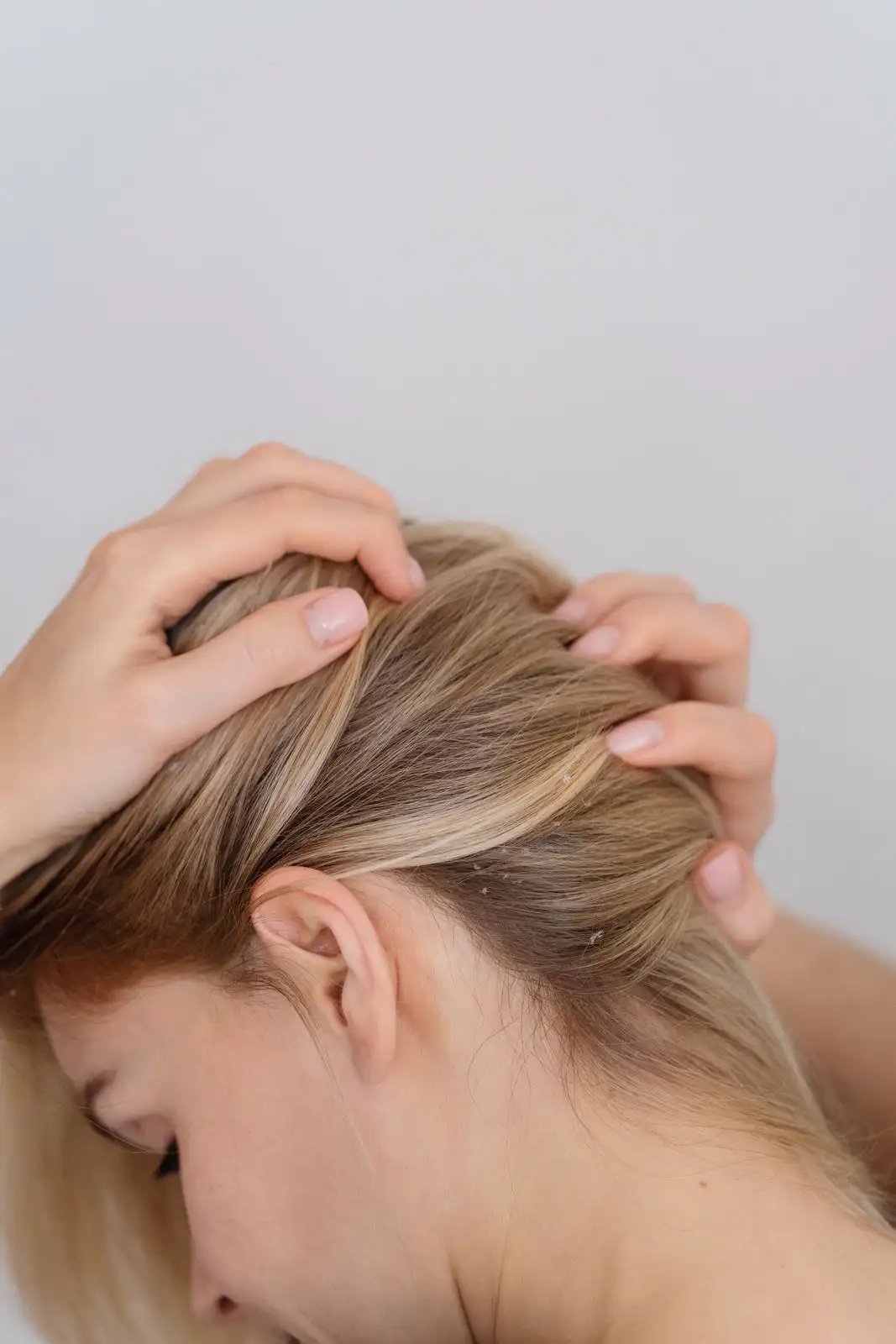 Hair and Scalp Restoration Treatments