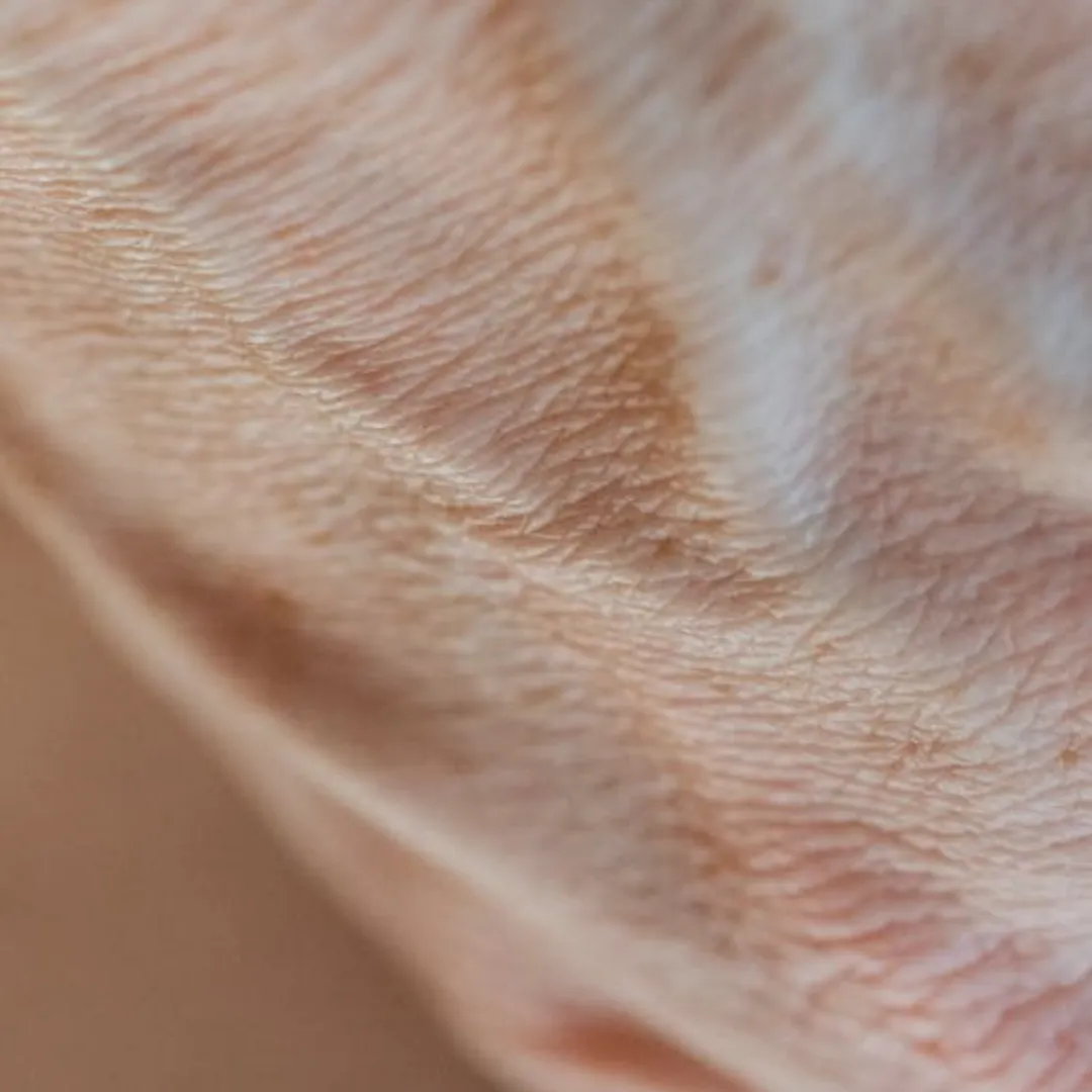 Wrinkle Treatment