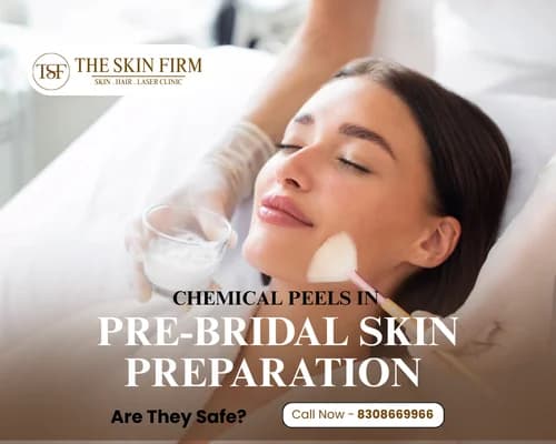 chemical peel