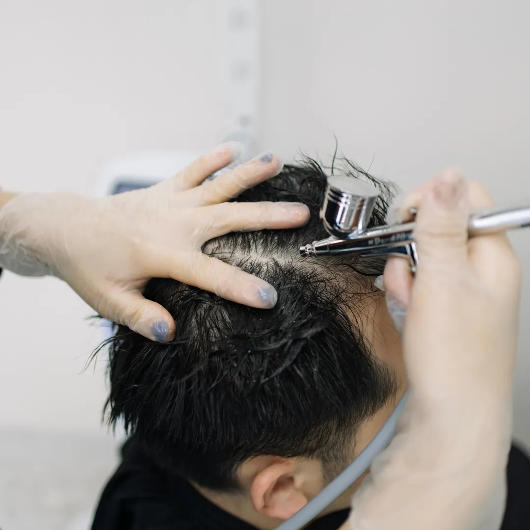 Hair Mesotherapy