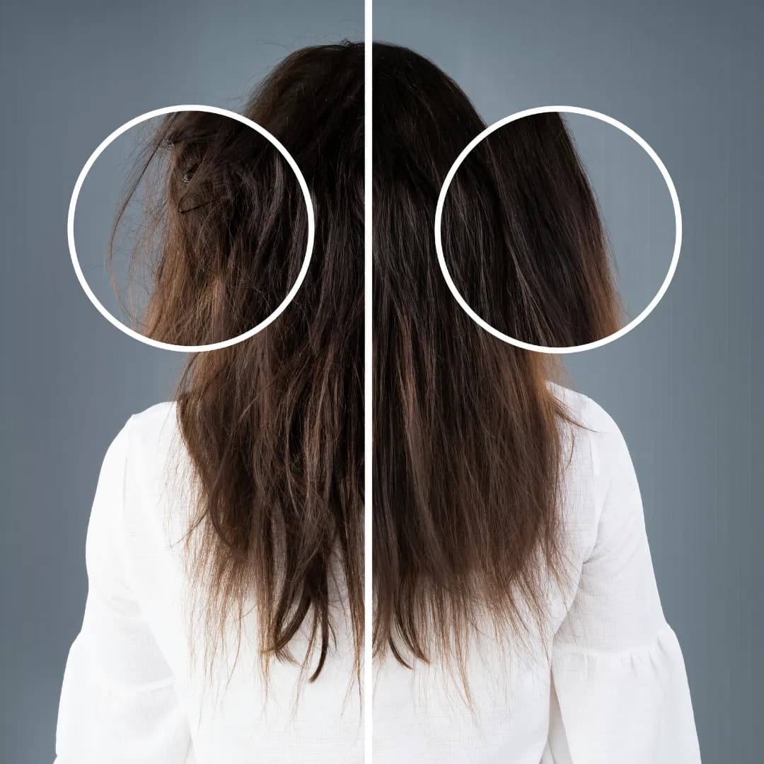 Hair Regrowth & Density Improvement