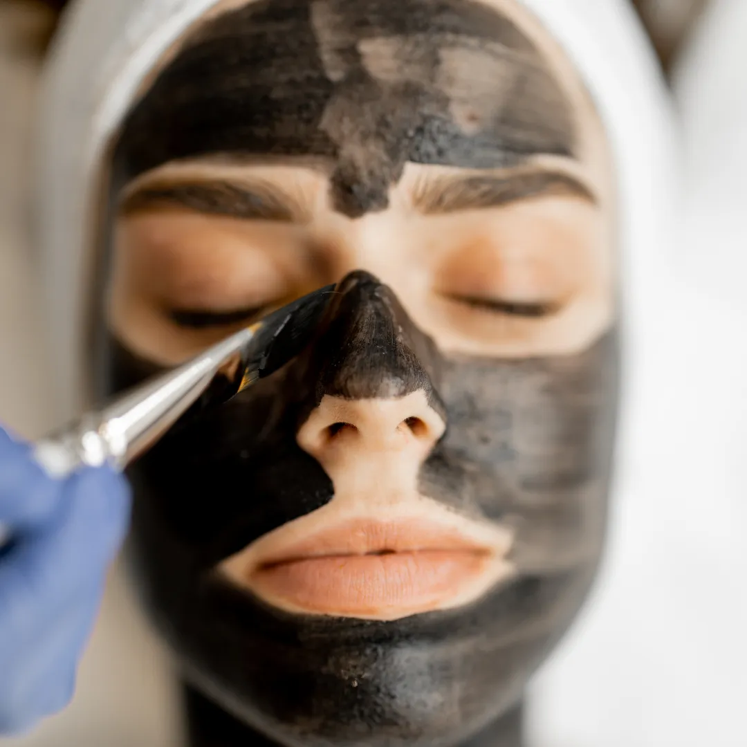 Carbon Peel Facial