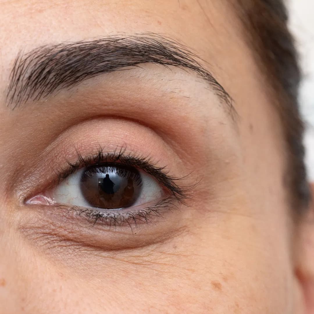Dark Circle & Under Eye Treatment