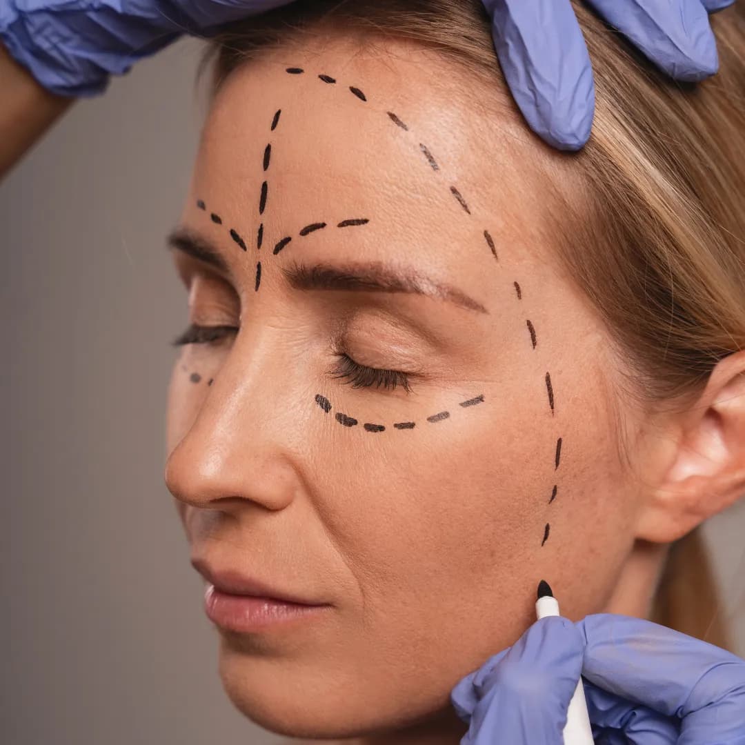 HIFU Treatment