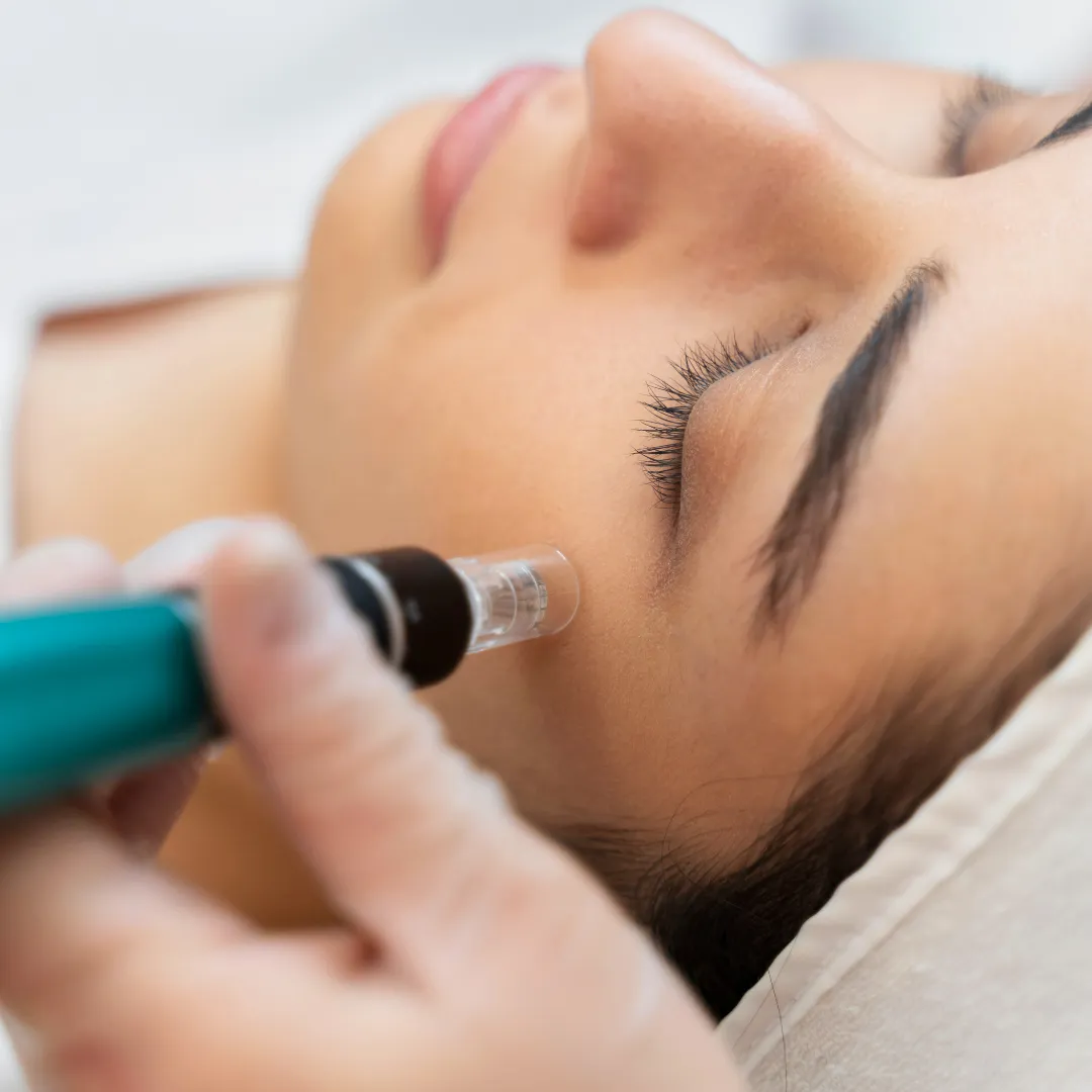 HydraFacial
