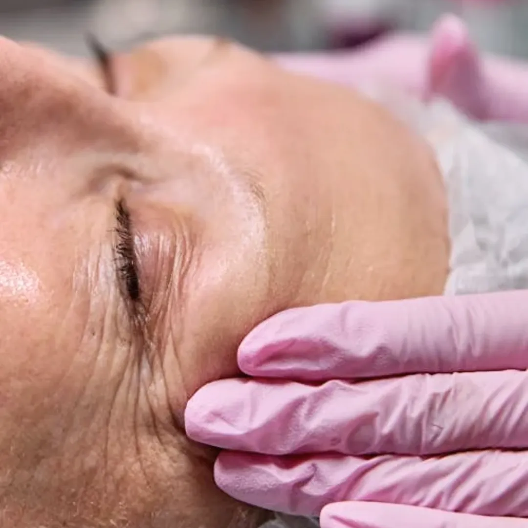 Anti-Ageing Treatment