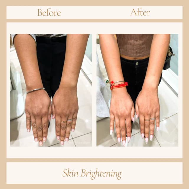 skin brightening 