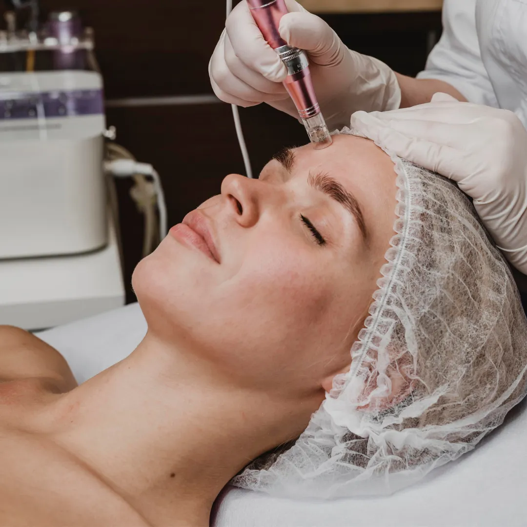 PRP Facial