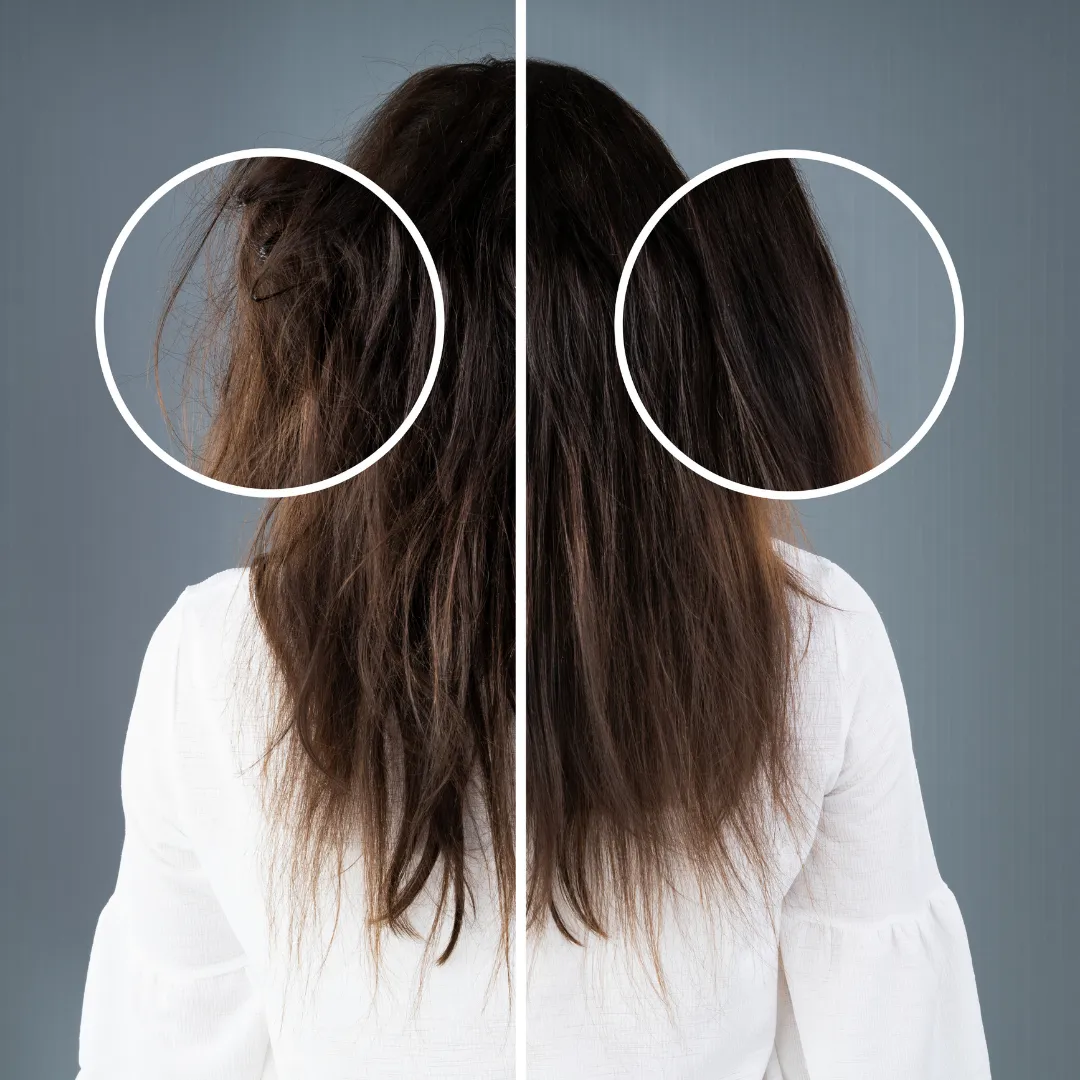 Hair Regrowth & Density Improvement
