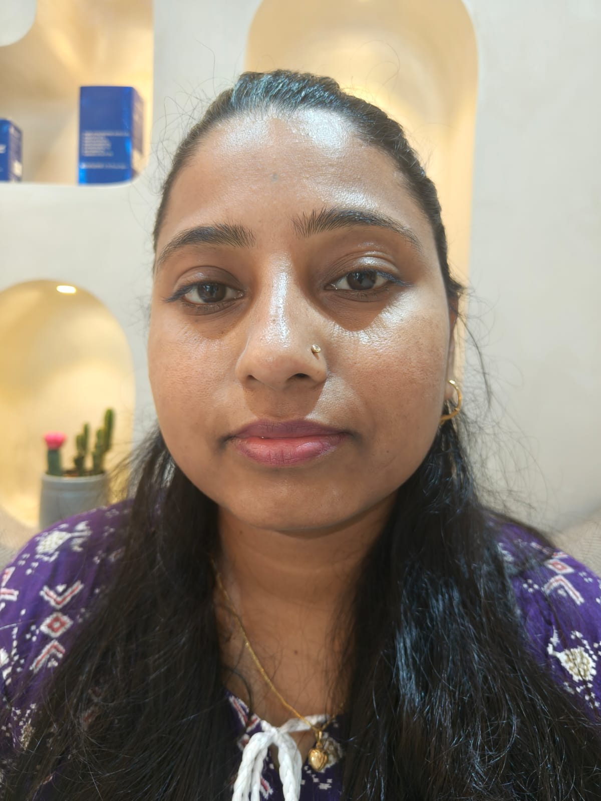 After Acne Scar Treatment