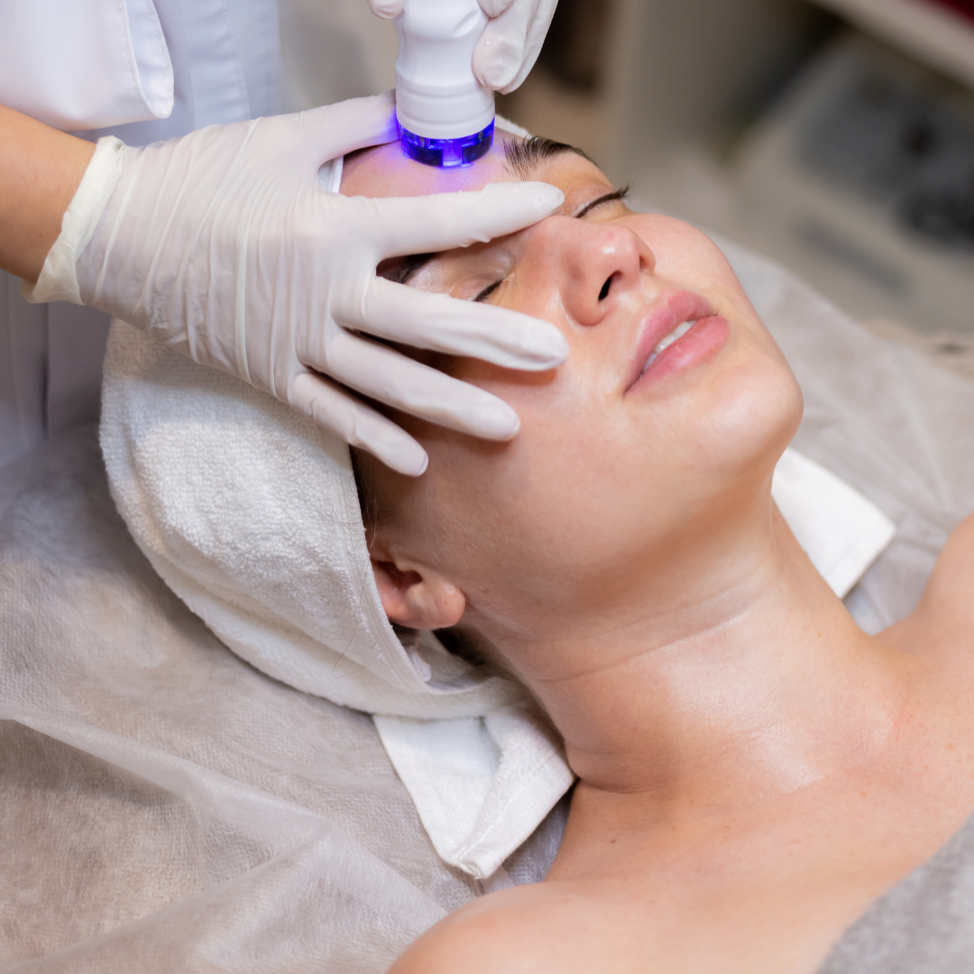 Microdermabrasion