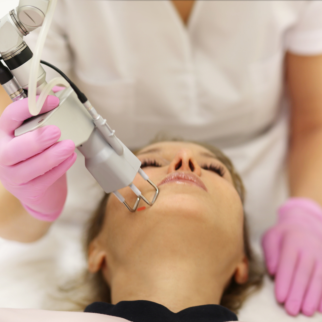CO2 Laser for Skin Process