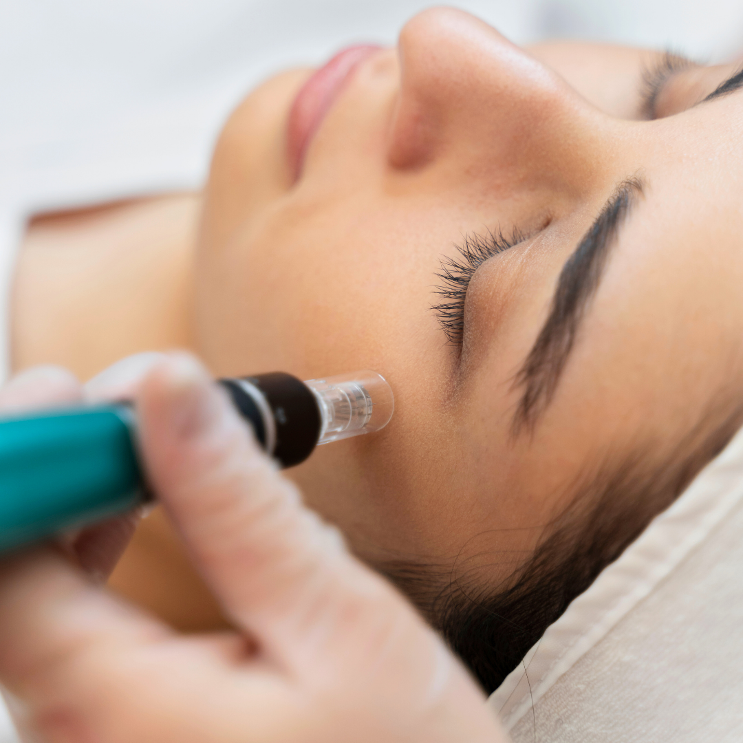 Hydrafacial Treatment