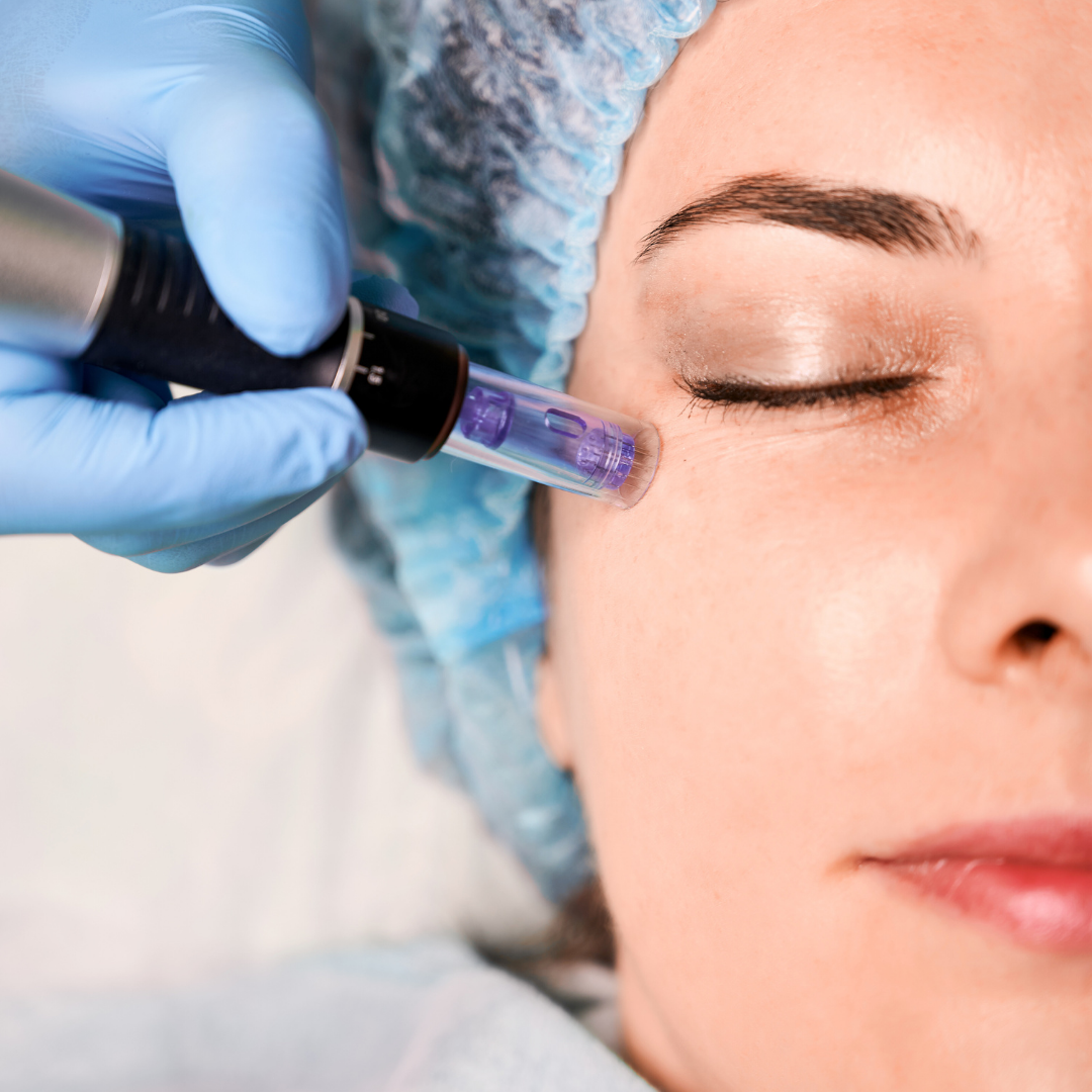 Mesotherapy For Skin