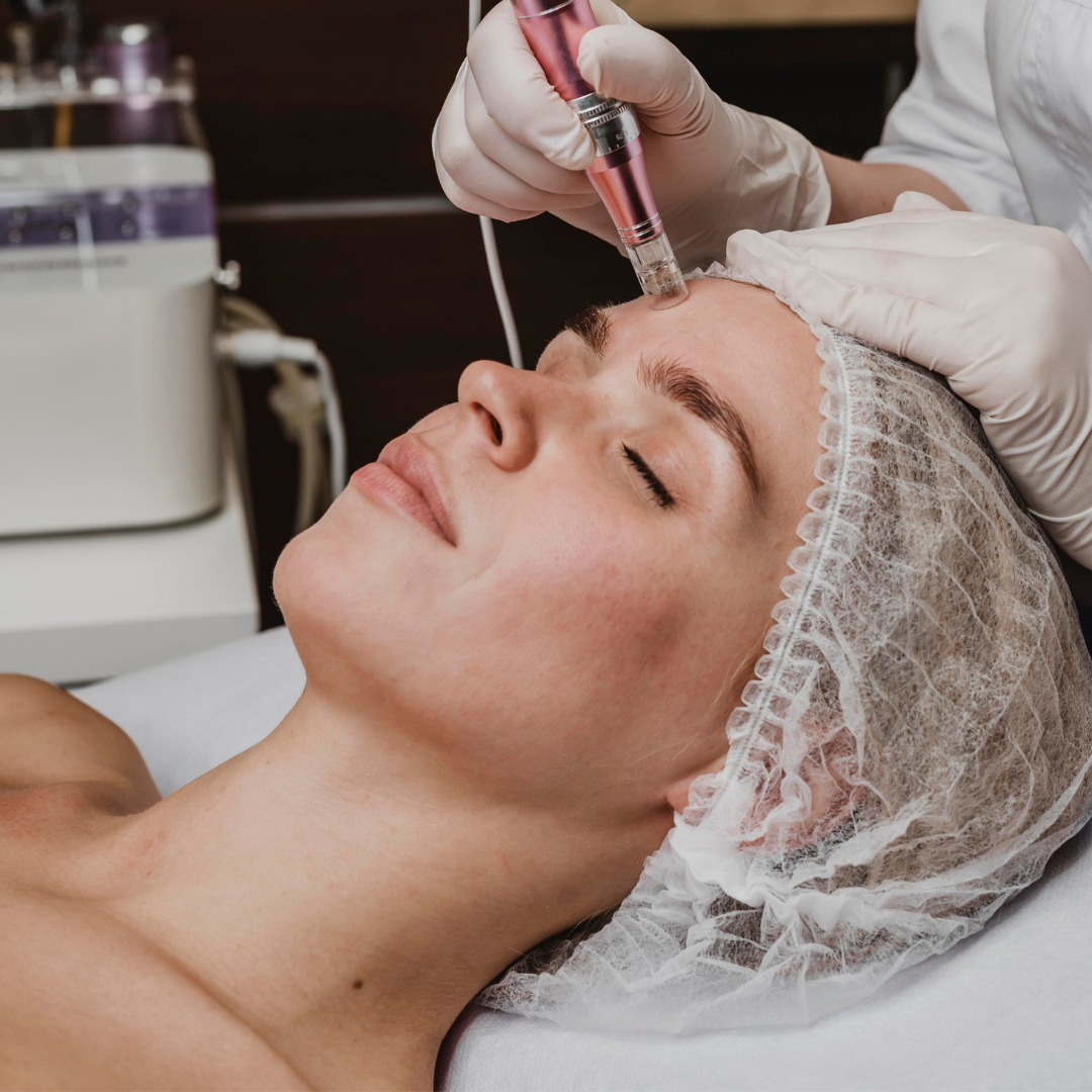 PRP Facial