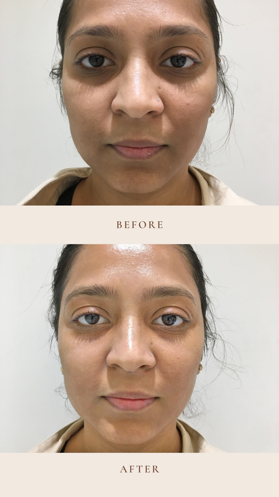 Brown-Abstract-Shapes-photo-before-and-after-skincare-Instagram-Story---1