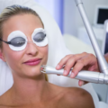 The Comprehensive Guide to Laser Hair Removal in Pune: Achieving Smooth Skin with The Skin Firm.