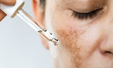 Pigmentation Treatment
