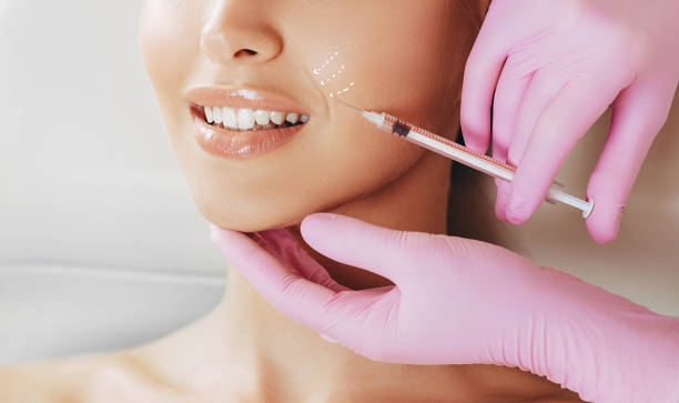 Dermal Fillers